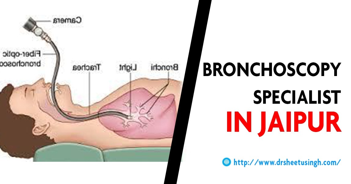 Bronchoscopy Specialist in Jaipur