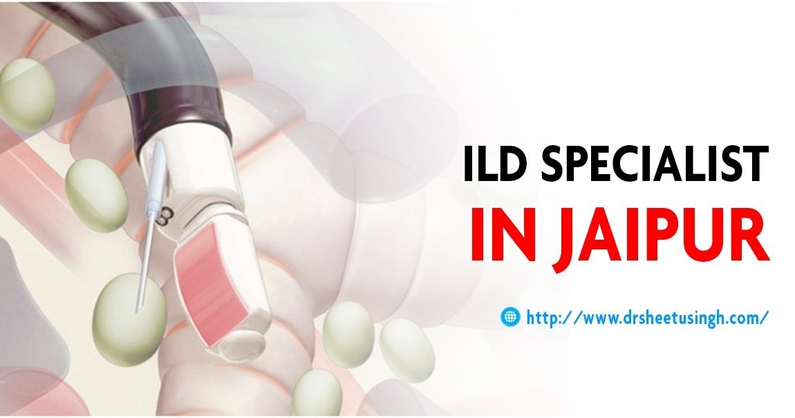 ILD Specialist In Jaipur