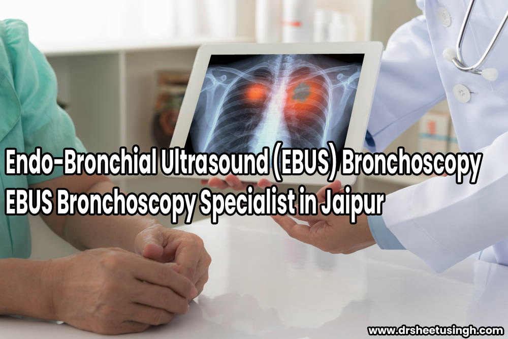EBUS Bronchoscopy Specialist in Jaipur Endo-Bronchial Ultrasound (EBUS) Bronchoscopy