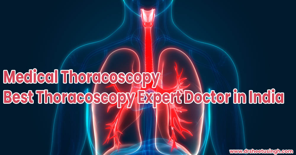 Medical Thoracoscopy Best Thoracoscopy Expert Doctor in India