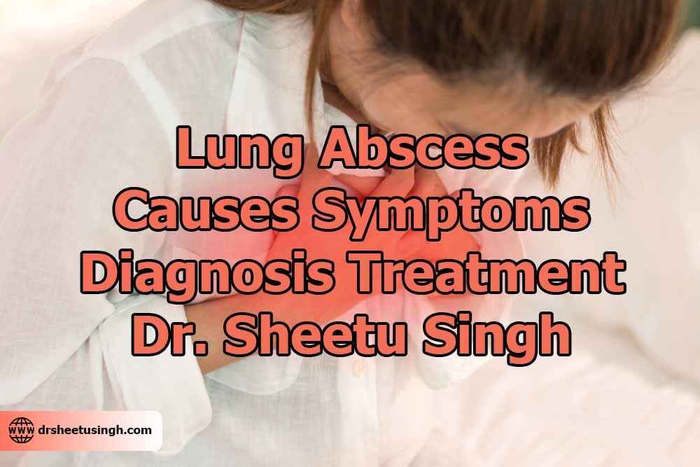 Lung Abscess: Causes, Symptoms, Diagnosis, Treatment - Dr. Sheetu