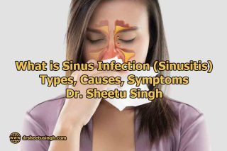 What is Sinus Infection (Sinusitis) Types, Causes, Symptoms