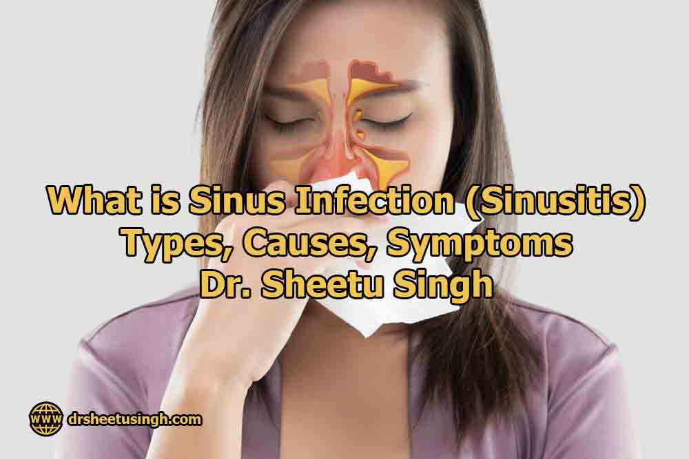 What-is-Sinus-Infection-Sinusitis-Types-Causes-Symptoms-Dr.-Sheetu-Singh.jpg
