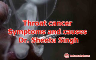 Throat cancer Symptoms and causes Dr. Sheetu Singh