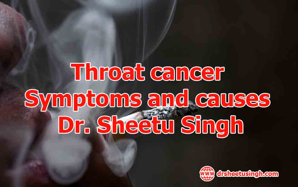 Throat-cancer-Symptoms-and-causes-Dr.-Sheetu-Singh.jpg