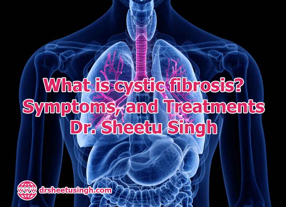 What is cystic fibrosis Symptoms, and Treatments - Dr. Sheetu Singh