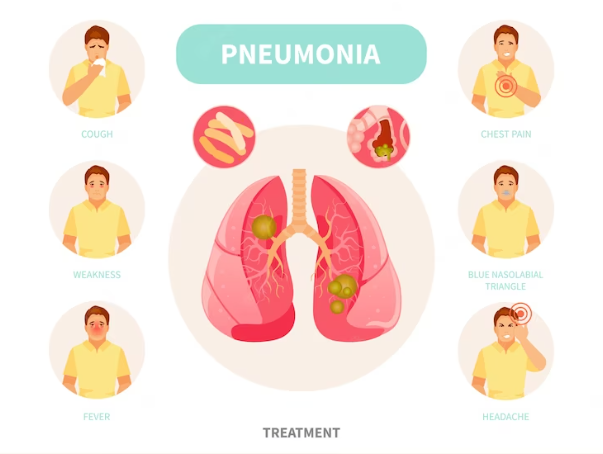Diagnosis and Treatment of Hypersensitivity Pneumonitis