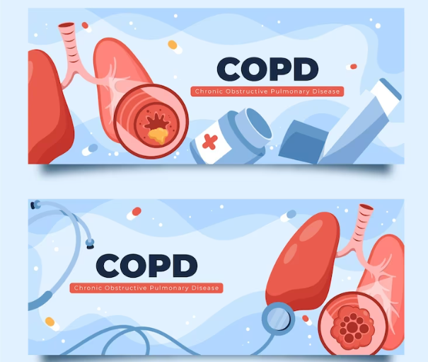 Exploring Inhaler Treatment Options for COPD